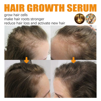 Hair Growth Repair Care Essential Oil - GimmeWarehouse